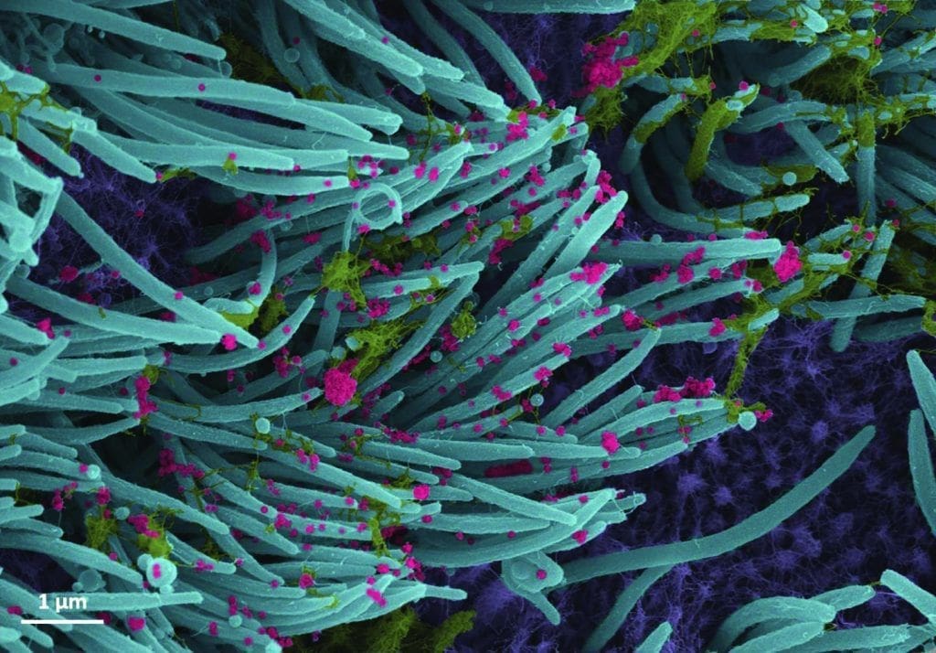 This is What Covid Looks Like, Plus All the Health News For October